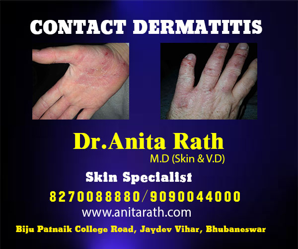 best skin treatment clinic in bhubaneswar, odisha near me